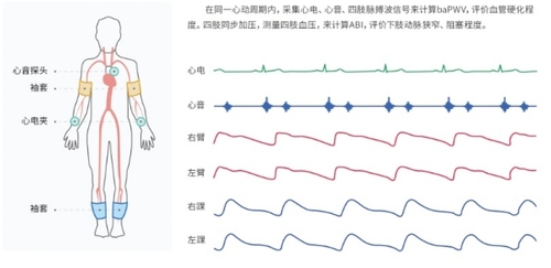 動脈硬化檢測儀檢查部位